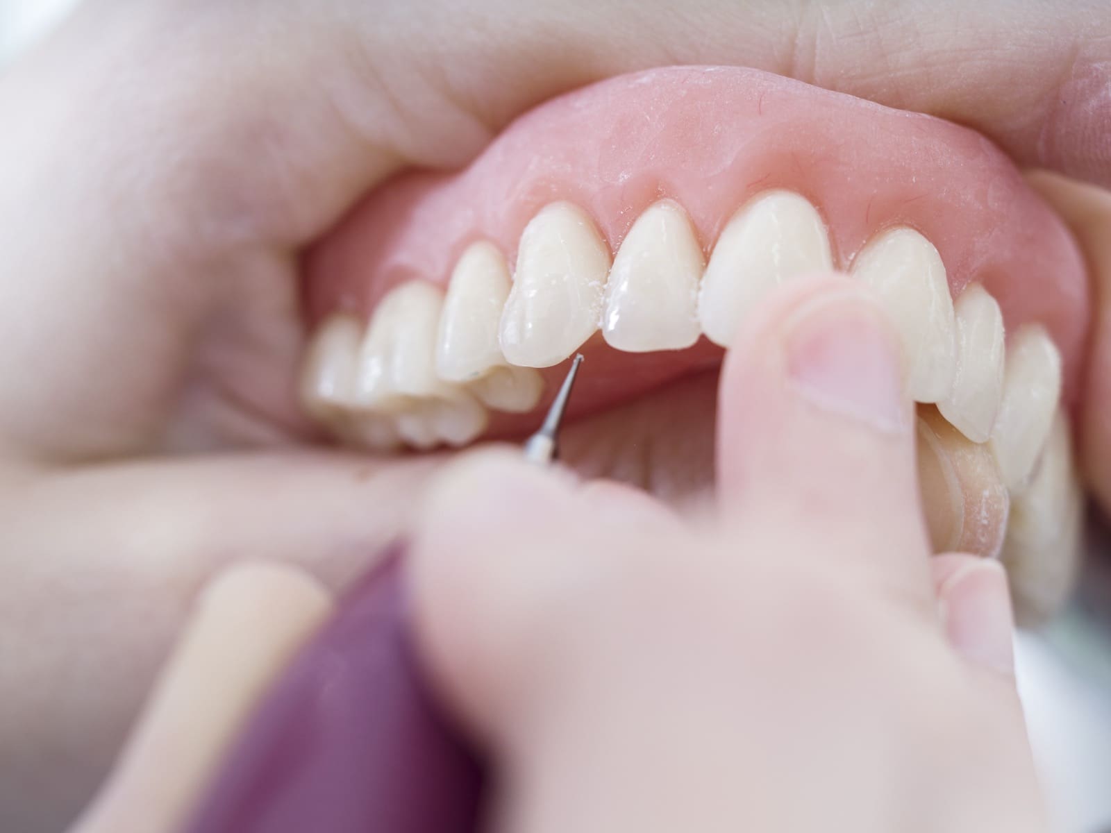 Dental technician is working with porcelain teeth in a cast mold in dental laboratory.
