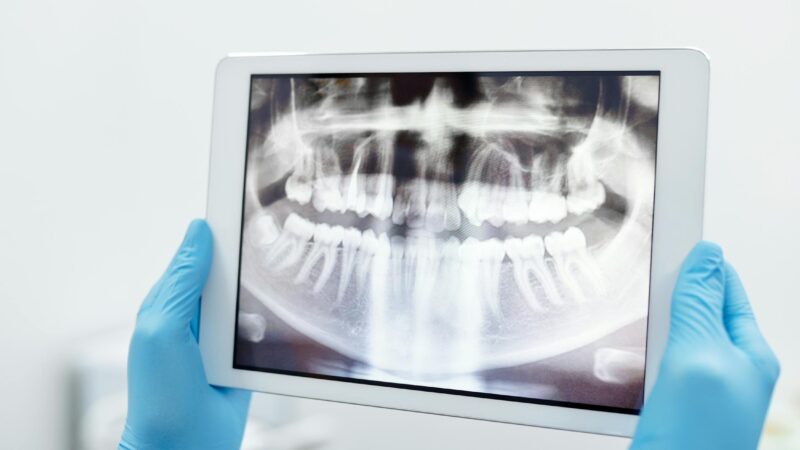 Dental professional reviewing a digital X-ray on a tablet — representing AI technology in Canadian dental care