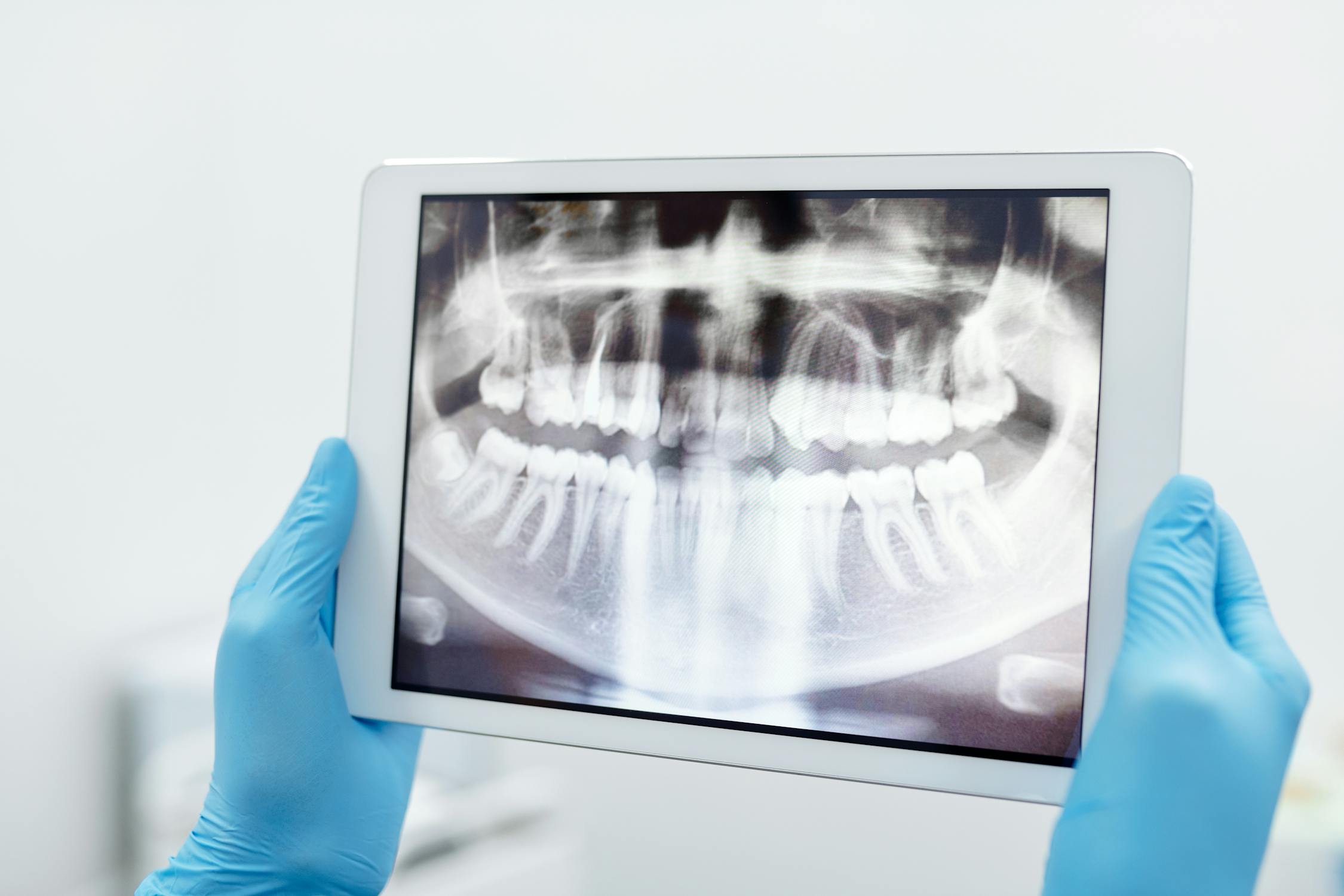 How AI Is Changing Dental Care in Canada