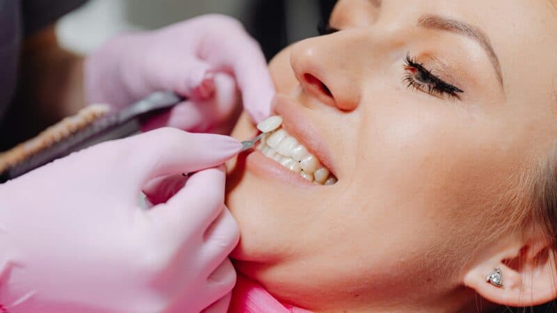 Person smiling showing dental veneers results