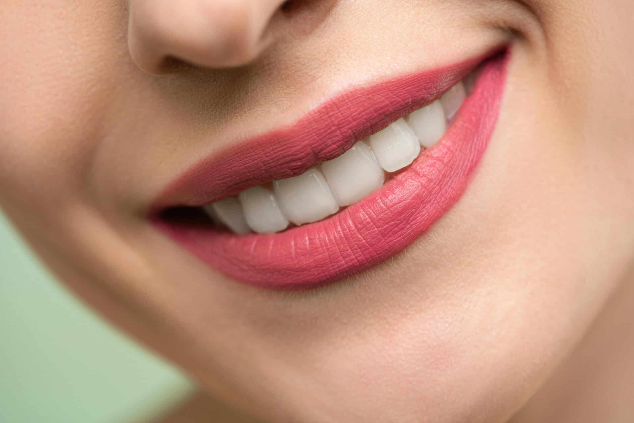 Teeth Whitening Options in Canada: Costs, Types & What to Expect